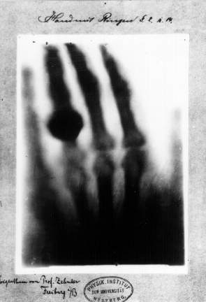 First medical X ray by Wilhelm Röntgen of his wife Anna Bertha Ludwigs hand 18951222